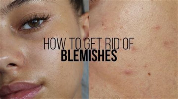 How do you fix blemishes on pictures?