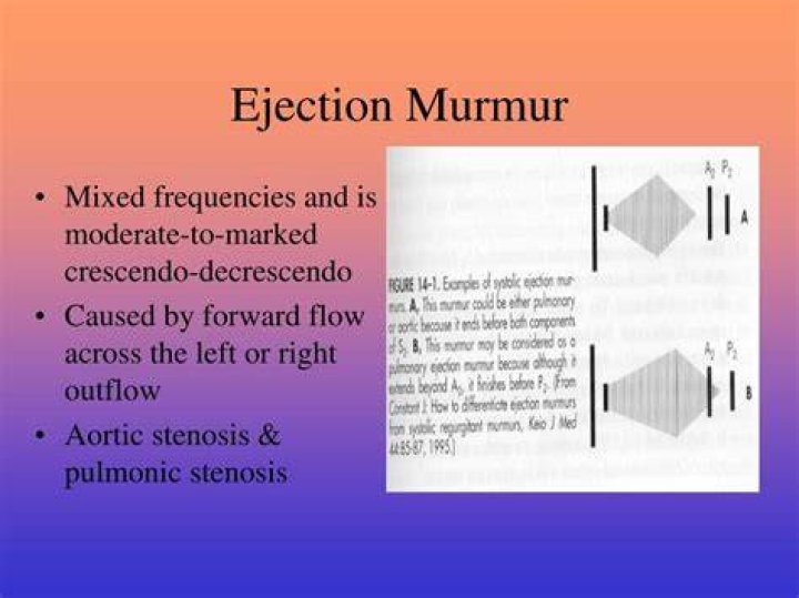 What is a 2 6 ejection systolic murmur?